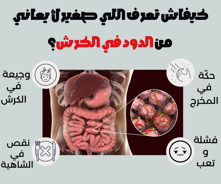 أعراض مرتبطة بالانزعاج في الكرش